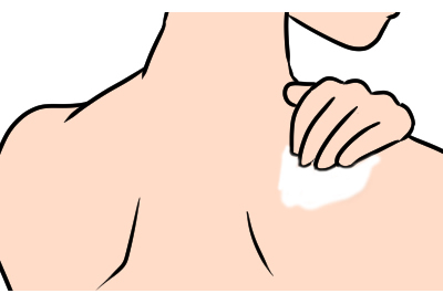 背中のニキビ予防